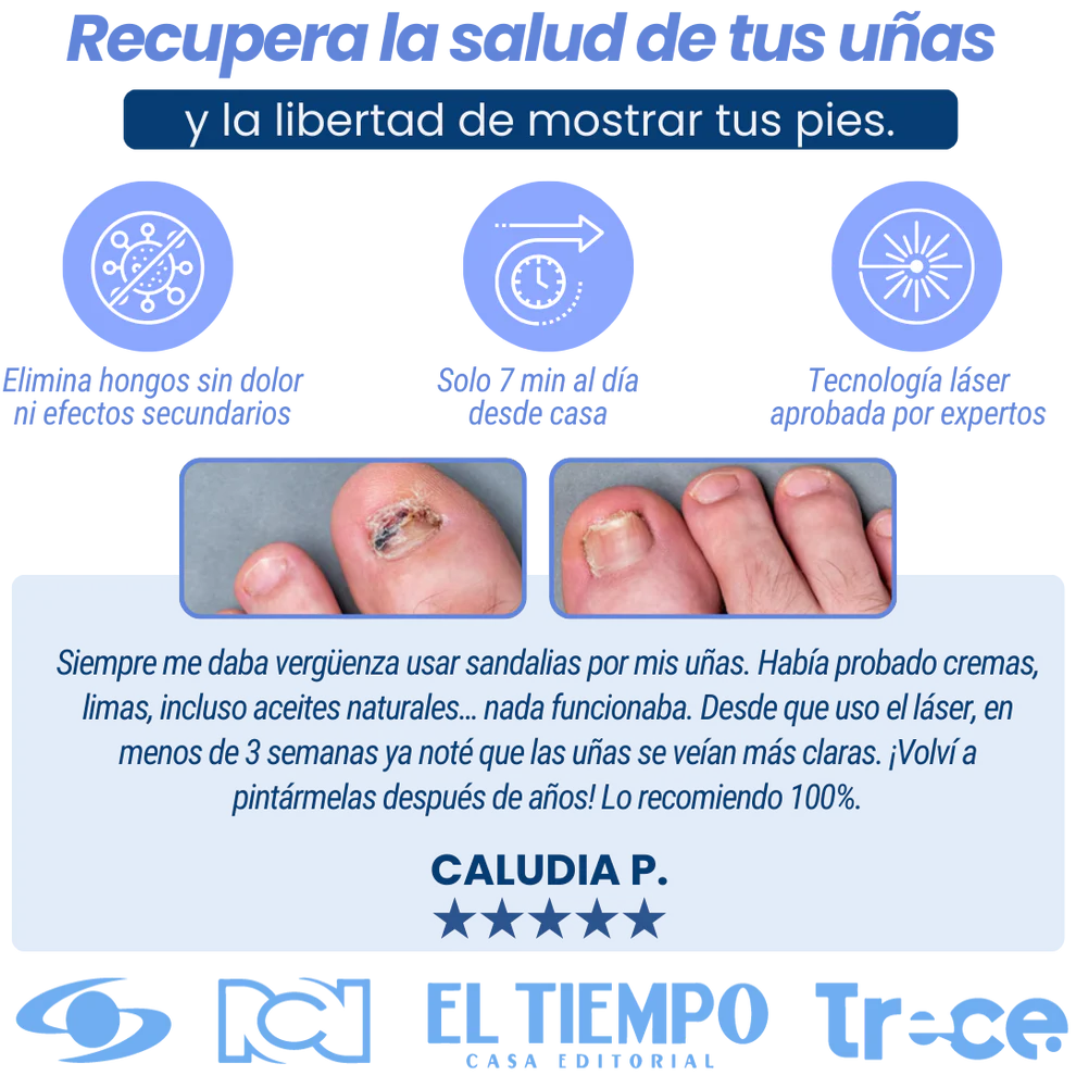 Adiós Hongos YA: Dispositivo no invasiso indoloro Elimina el hongo sin dolor (7 Dias / 99% de exactitud)