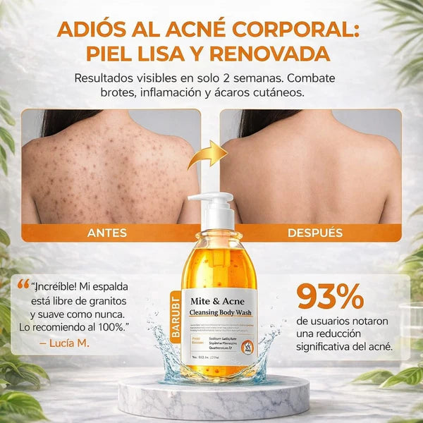 CLEANSING BODY WASH - ELIMINA QUERATOSIS - ACNE - CICATRICES Y ACLARA TU PIEL.