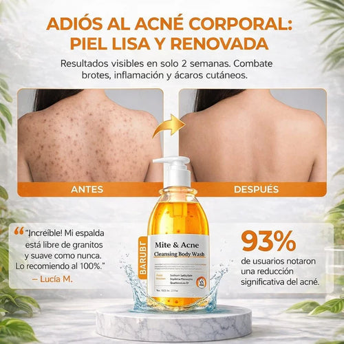 CLEANSING BODY WASH - ELIMINA QUERATOSIS - ACNE - CICATRICES Y ACLARA TU PIEL.