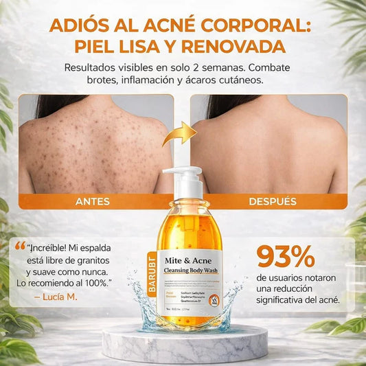 CLEANSING BODY WASH - ELIMINA QUERATOSIS - ACNE - CICATRICES Y ACLARA TU PIEL